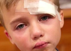 نشانههای ضربه مغزی در کودکان را بشناسید نشانههای ضربه مغزی در کودکان را بشناسید