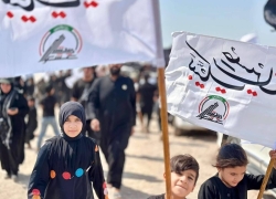 مراقبت از پوست در مسیر اربعین