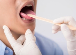 چگونه از روی زبان بیماریها را تشخیص دهیم؟ چگونه از روی زبان بیماریها را تشخیص دهیم؟