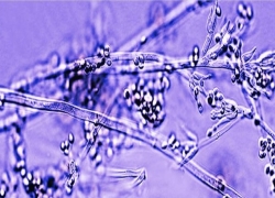 بانداژ قارچی؛ راهکار زنده و نوین برای درمان زخم‌ها