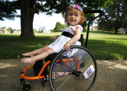 بیماری SMA یا آتروفی عضلانی نخاعی چیست؟