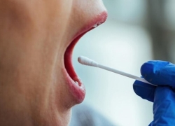 تُل و تل‌گیری در طب سنتی اسلامی