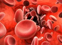 نسخه‌ سنتی برای تقویت خون‌سازی