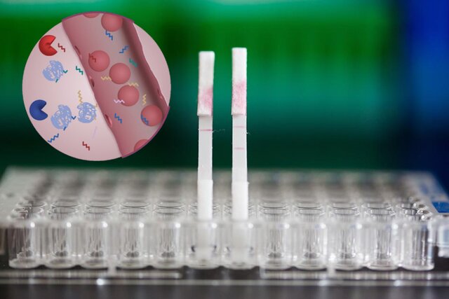 تشخیص زودهنگام سرطان در خانه با آزمایش ادرار