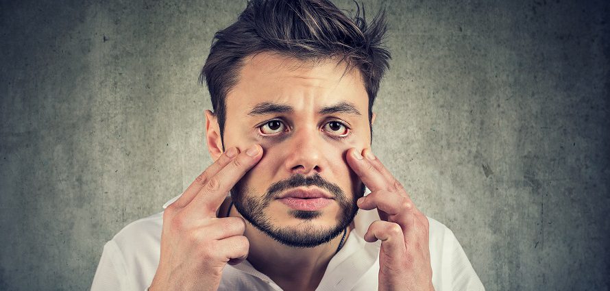 افتادگی پلک از دیدگاه طب ایرانی