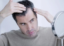 چگونه از ریزش مو پیشگیری کنیم؟