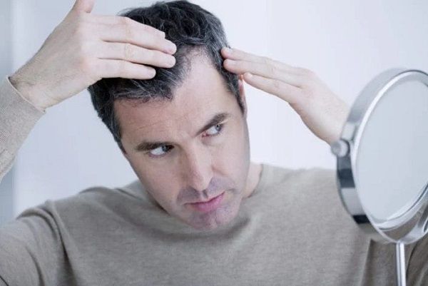 چگونه از ریزش مو پیشگیری کنیم؟